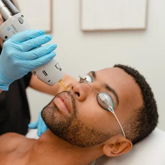 Laser Hair Removal - Best Barber S hop (1)